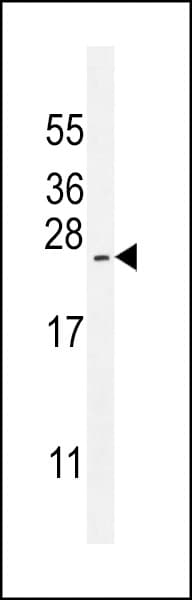 ARL17A Antibody (aa102-130)