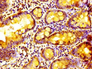 ALY / THOC4 Antibody