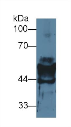 KRT14 / CK14 / Cytokeratin 14 Antibody (aa14-484, APC)