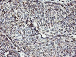 KCNJ3 / GIRK1 Antibody (clone OTI1G3)