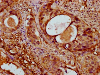 ACTA1 / Skeletal Muscle Actin Antibody