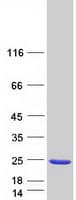 Human NUDCD2 Protein (Recombinant Myc-DDK (Flag))