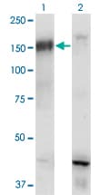 CML / BCR Antibody (clone 2E5)