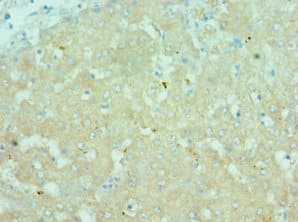 CTCFL / BORIS Antibody (aa1-270)