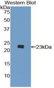 PIK3CB / PI3K Beta Antibody (aa321-507, Biotin)
