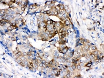 Polyclonal Rabbit anti-Human STMN1 / Stathmin / LAG Antibody (IHC, WB)