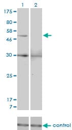Monoclonal Mouse anti-Human MMP13 Antibody (clone 3B11, WB)
