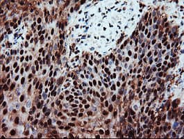 PSMA6 Antibody (clone OTI7C2)