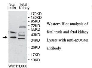 Polyclonal Rabbit anti-Human IZUMO1 / IZUMO Antibody (aa51-211, IHC, WB)
