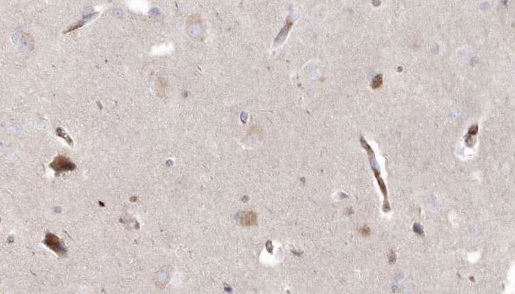 MPV17 Antibody