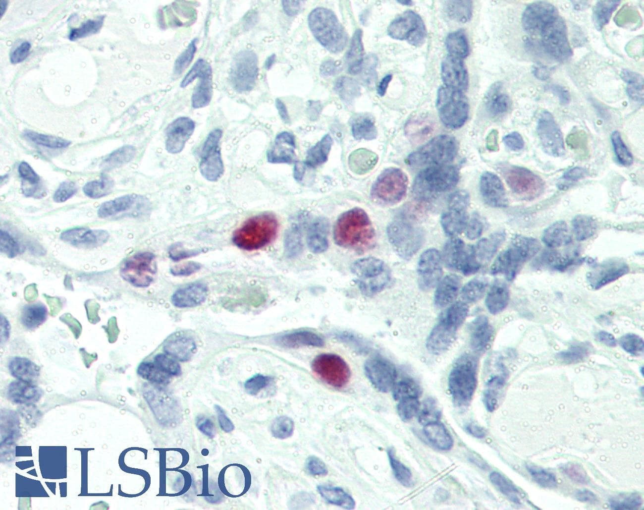 IHC-plus™ Monoclonal Mouse anti-Human SKP2 Antibody (IHC, WB)