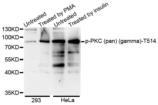 Polyclonal Rabbit anti-Human PRKCA / PKC-Alpha Antibody (phospho-Thr514, WB)