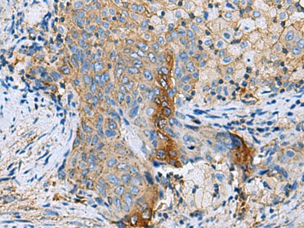 Polyclonal Rabbit anti-Human CLTB Antibody (IHC, WB)
