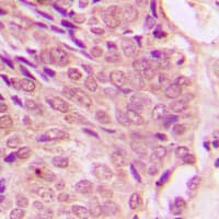 STAT1 Antibody (phospho-Ser727)
