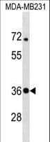 Polyclonal Rabbit anti-Human STX4 / Syntaxin 4 Antibody (aa132-160, WB)