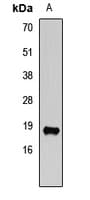 VAMP2 / VAMP-2 Antibody
