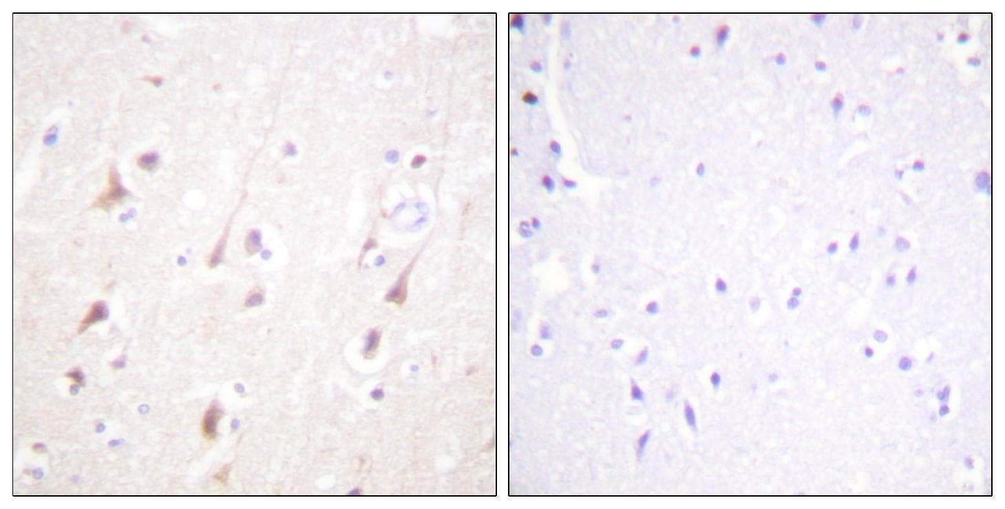 IRS1 Antibody (Ab-794)