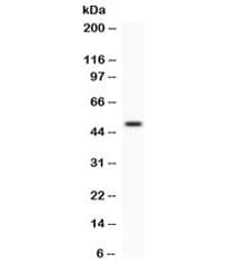 FCGRT / FCRN Antibody