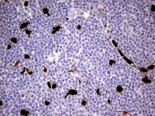 S100A9 / MRP14 Antibody (clone UMAB174, Carrier-free)