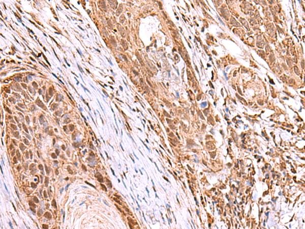 RCOR3 Antibody