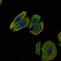 SCGB2A2 / Mammaglobin A Antibody (clone 3C8)