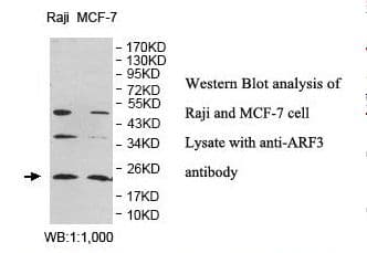 Polyclonal Rabbit anti-Human ARF3 Antibody (aa2-181, IHC, WB)