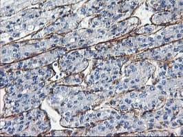 Monoclonal Mouse anti-Human ARH / LDLRAP1 Antibody (clone OTI4B10, IHC, WB)
