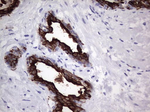 KRT19 / CK19 / Cytokeratin 19 Antibody (aa240-390, clone OTI3D10)