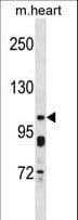 Polyclonal Rabbit anti-Human KCNQ5 Antibody (aa781-809, WB)