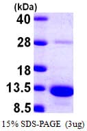Human S100A5 Protein (Recombinant His)