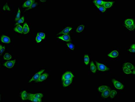 HnRNPLL / HNRPLL Antibody