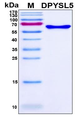 Human DPYSL5 / CRMP5 Protein (Recombinant 6His, N-terminus)