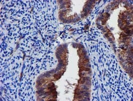 EPN2 Antibody (clone OTI1E4)