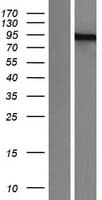 PML Protein (Over-Expression Lysate Myc-DDK (Flag))