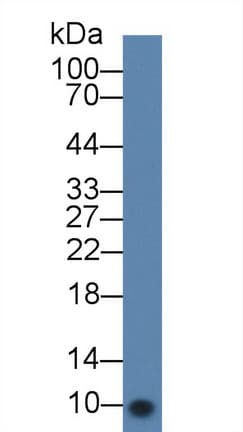 CXCL7 / PPBP Antibody (aa40-113)