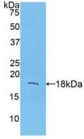 Mouse FGF1 / Acidic FGF Protein (Recombinant His, N-Terminal)