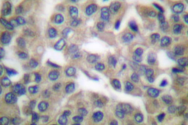 HSPA5 / GRP78 / BiP Antibody (Pro641)