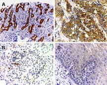 BAR / BFAR Antibody (aa1-139)