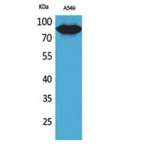 MME / CD10 Antibody (491-540 aa, Internal)