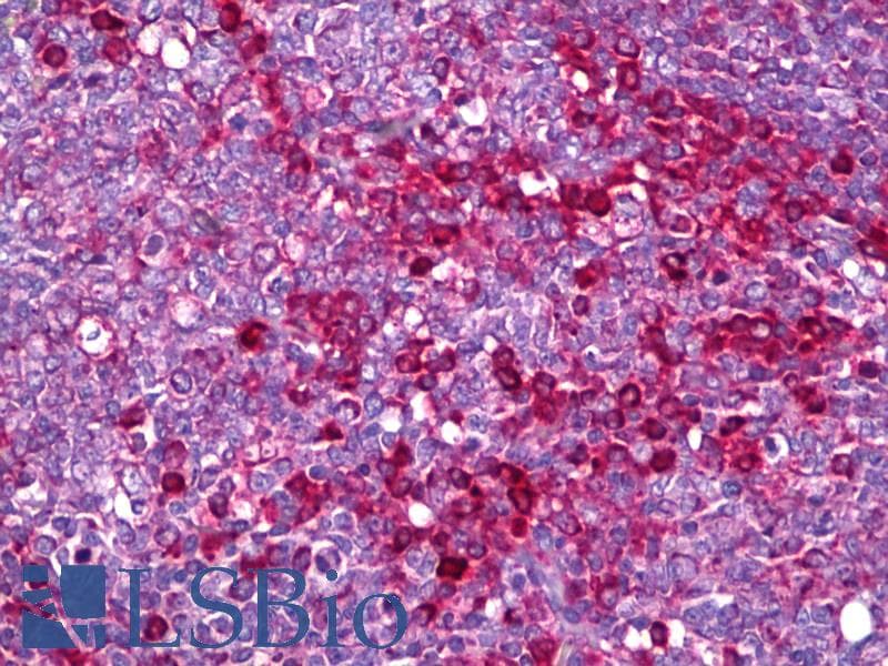 IHC-plus™ LGALS8 / Galectin 8 Antibody (aa61-110)