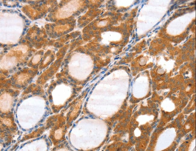 Polyclonal Rabbit anti-Human SRGAP3 Antibody (IHC)