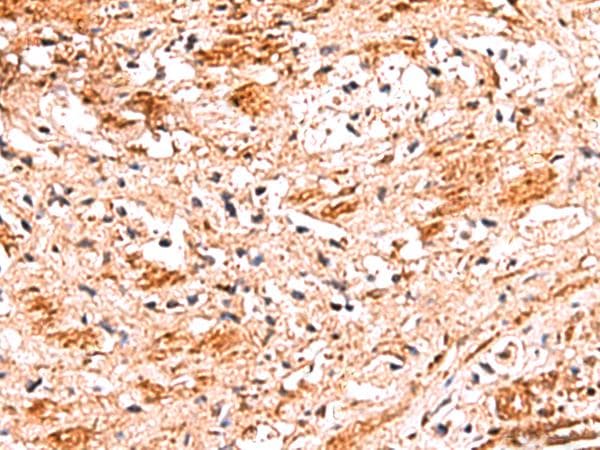 Polyclonal Rabbit anti-Human NADK / NAD Kinase Antibody (IHC)