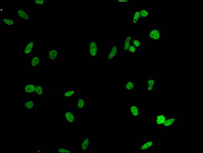 HIST1H1E Antibody