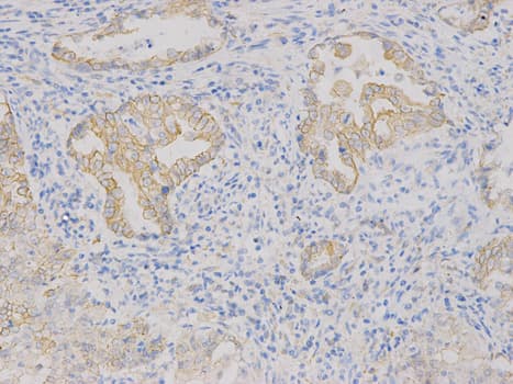 VEGFB Antibody