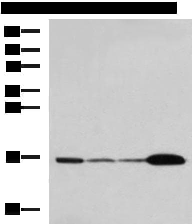UBE2N / UBC13 Antibody