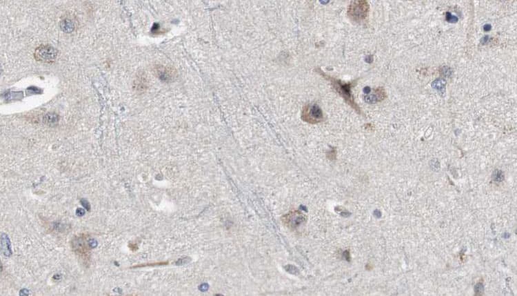 IL1RAPL2 Antibody