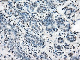 IDH1 / IDH Antibody (clone OTI2H9)