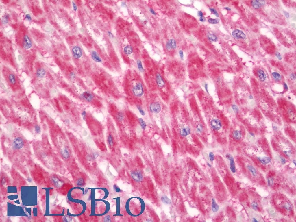 IHC-plus™ Polyclonal Rabbit anti-Human SLC22A5 / OCTN2 Antibody (aa282-331, IHC, WB)