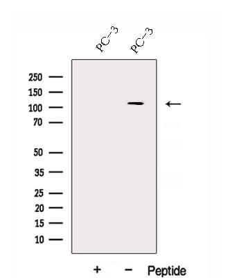 Polyclonal Rabbit anti-Human DHX36 Antibody (WB)