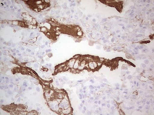 CSF1 / MCSF Antibody (aa223-496, clone OTI2D6)